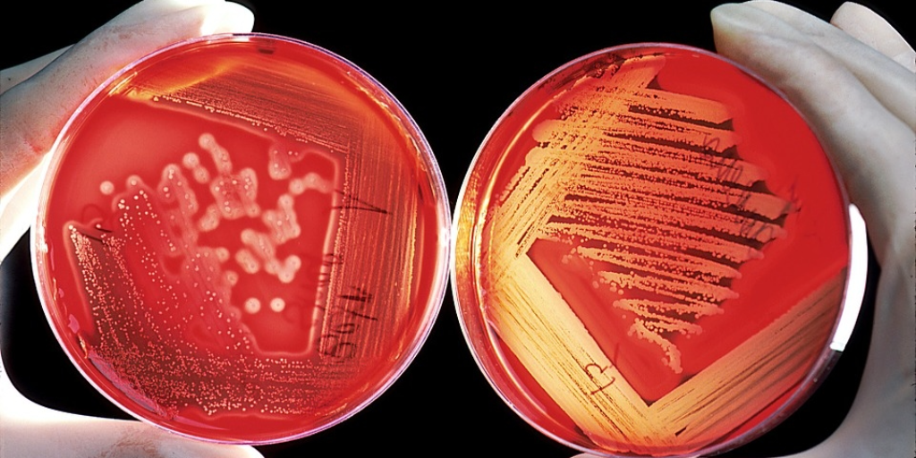 Expanding Our View of the Human Microbiome