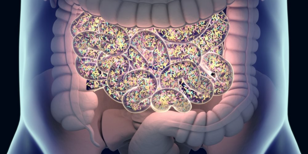 One More Small Piece of the  Puzzle on the Role of Gut Micro Organisms in MS